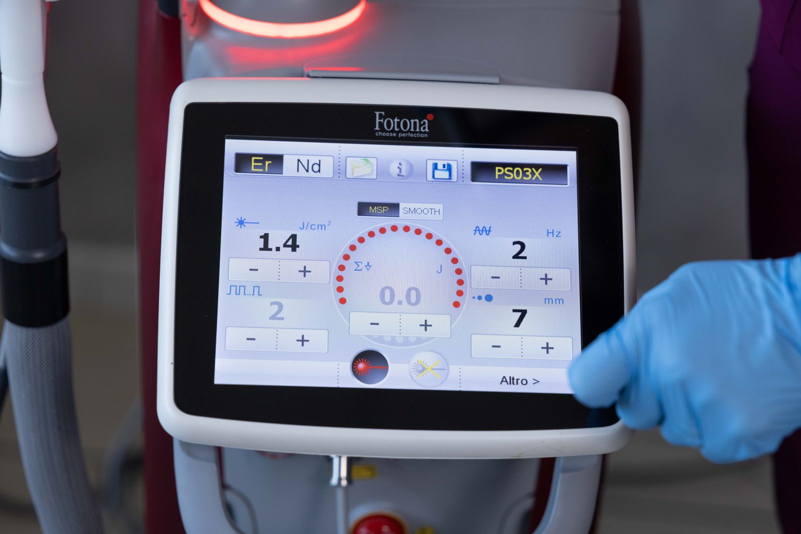 Console del laser Fotona TimeWalker